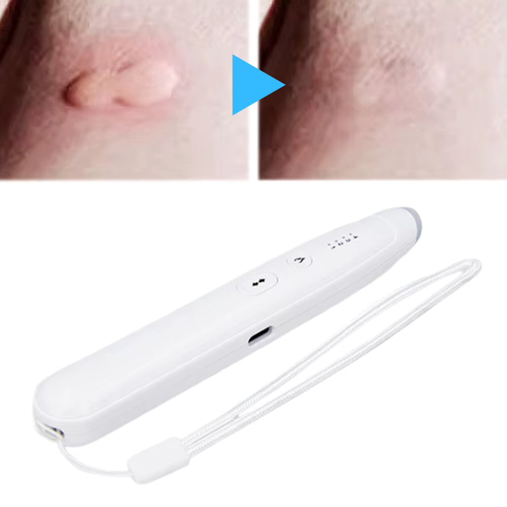 CalmoStick apaise les piqures