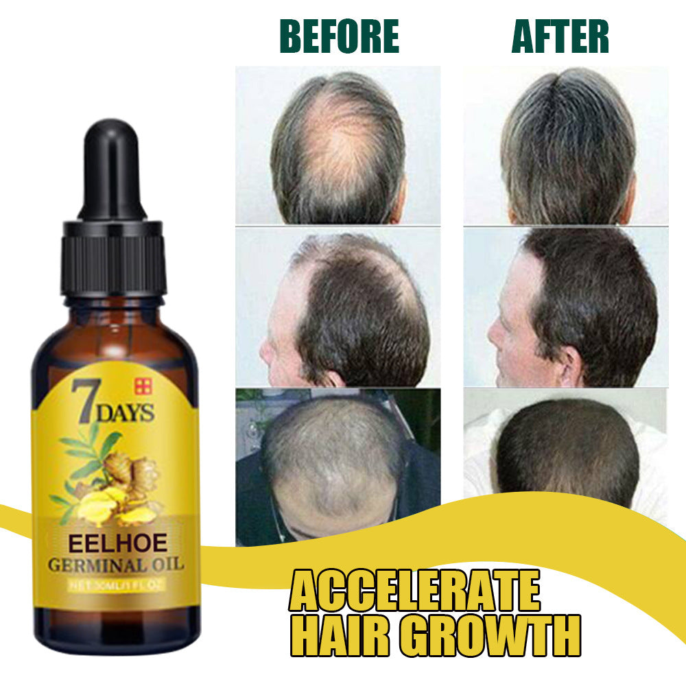 EELHOE Ginger Hair Growth Fluid