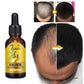 EELHOE Ginger Hair Growth Fluid